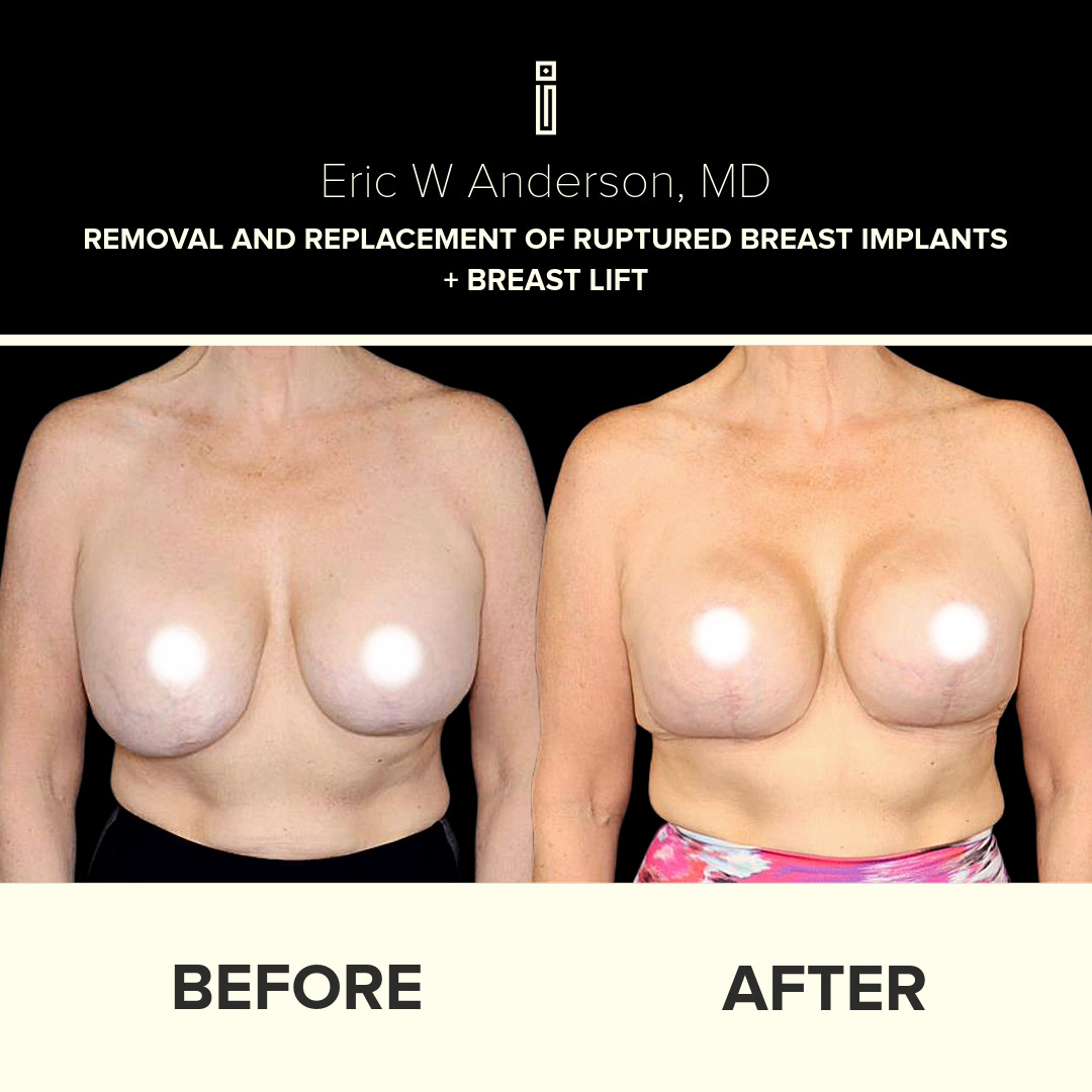 Dr.Anderson_B&A Folder 2-19