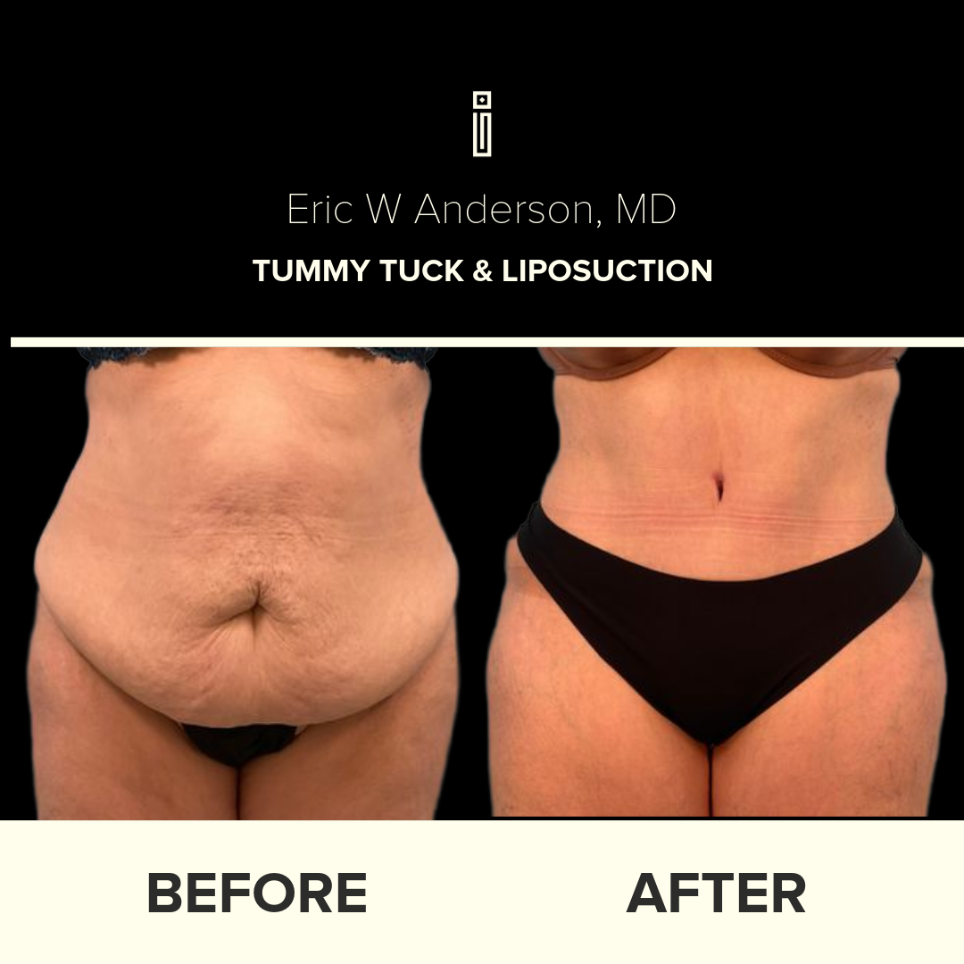 Dr.Anderson_B&A Folder 2-87-Dawn. h