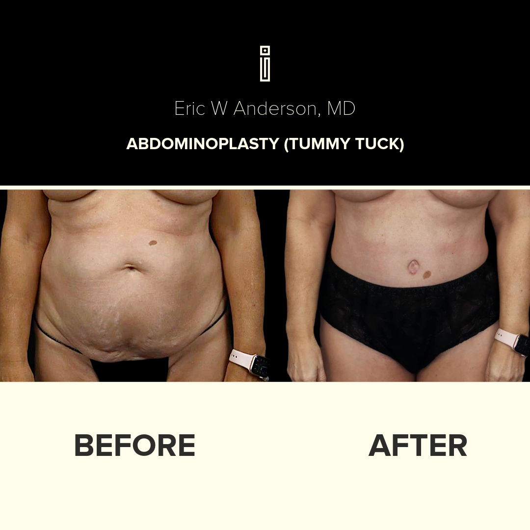 Dr.Anderson_B&A copy-22-Roche1