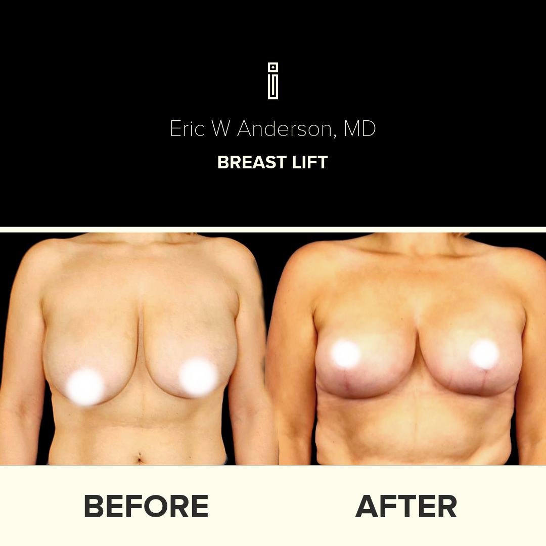 Dr.Anderson_B&A copy-31-Megan Bilodeau