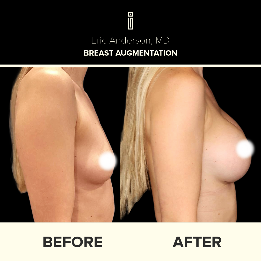 Dr.Anderson_B&A copy-40-Cheyanne3