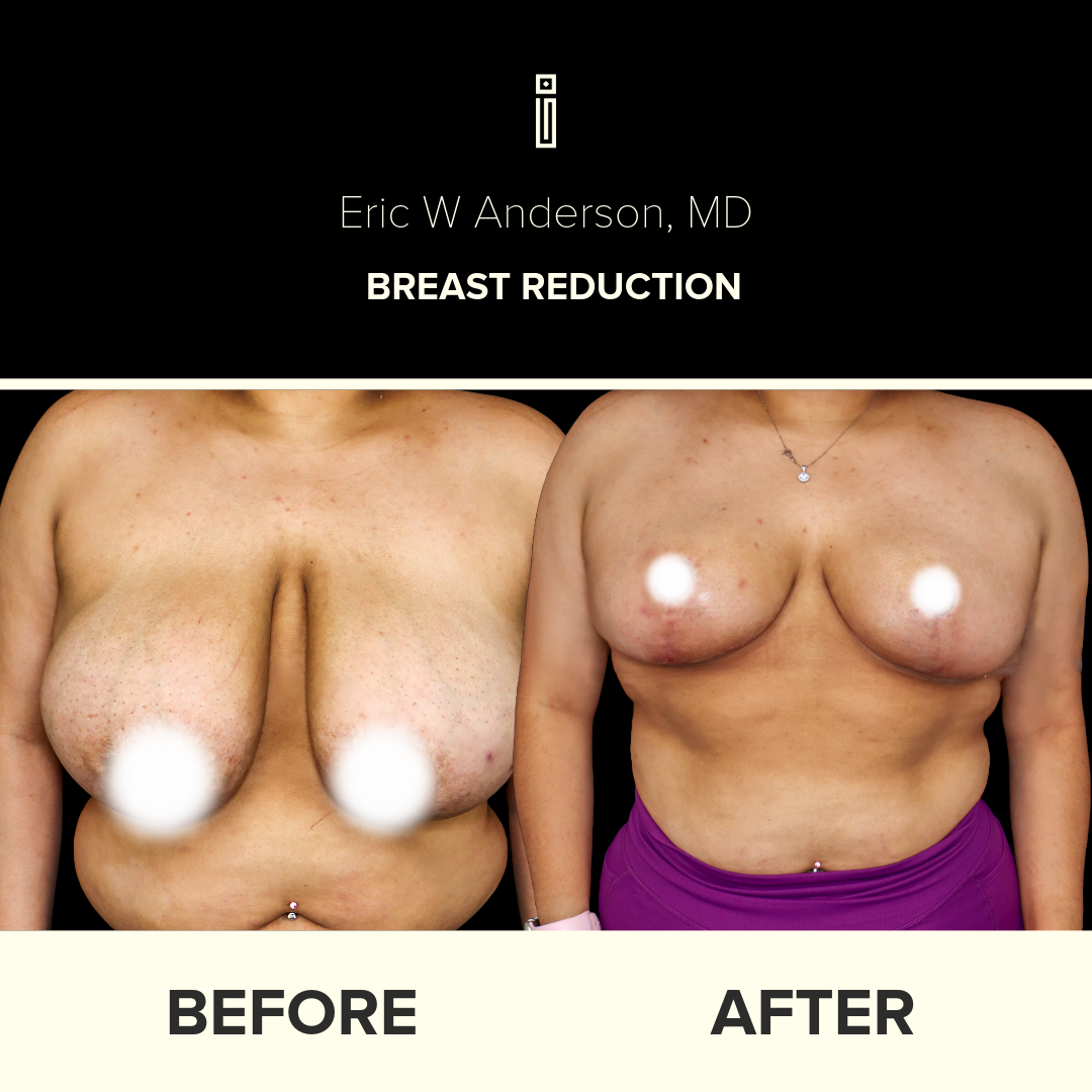 Dr.Anderson_B&A copy-47-2