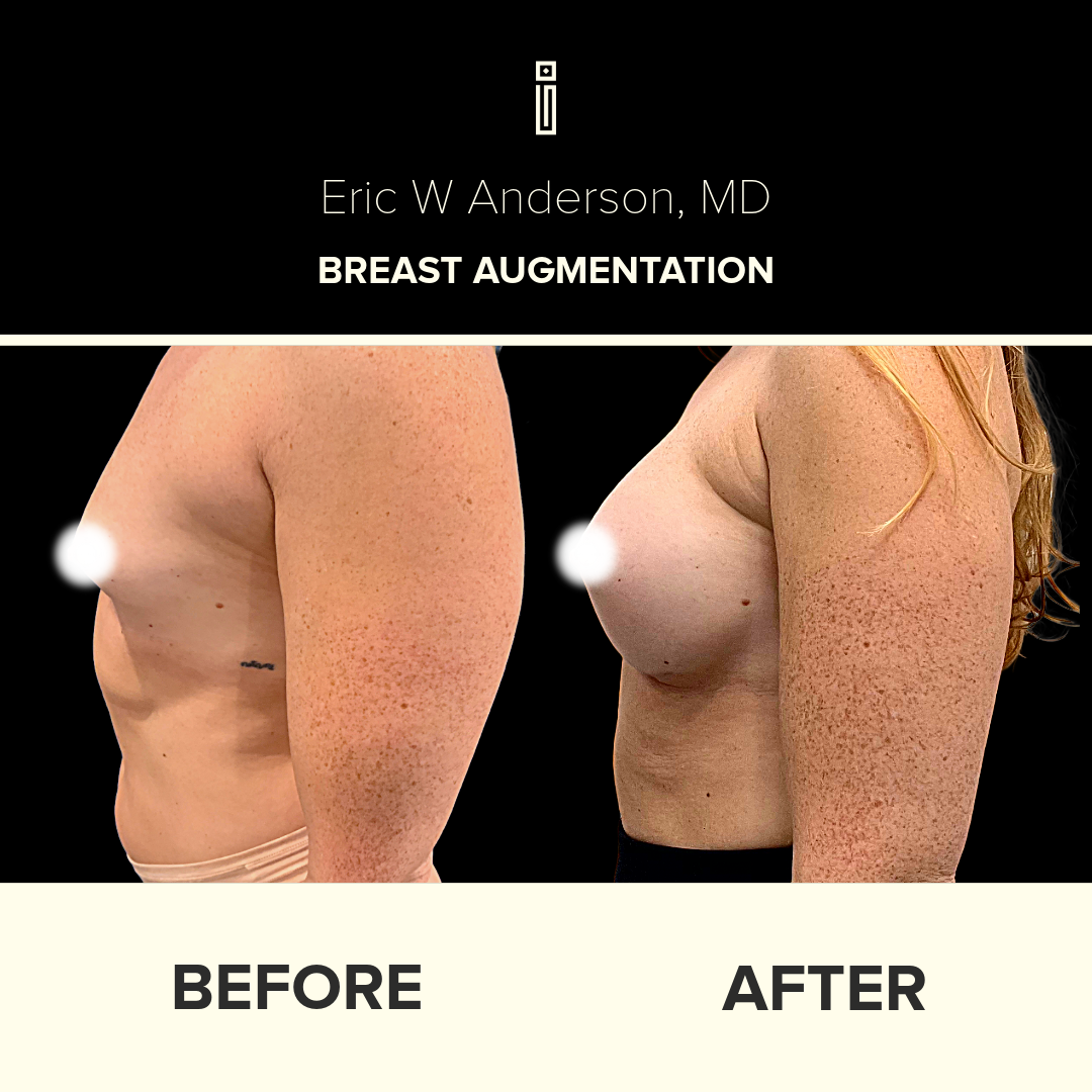 Dr.Anderson_B&A copy-53