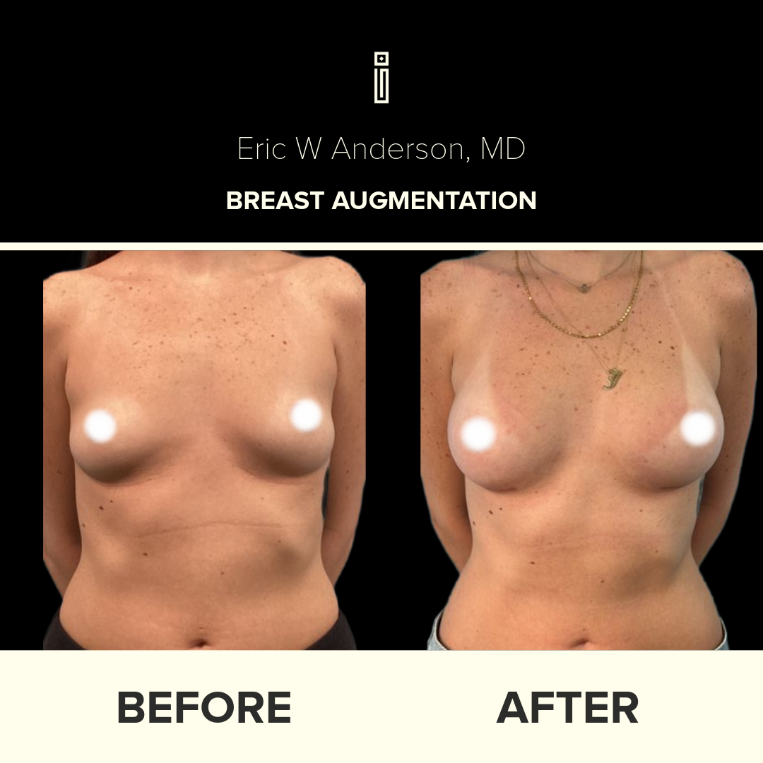 Dr.Anderson_B&A copy-66-Jina Boktor