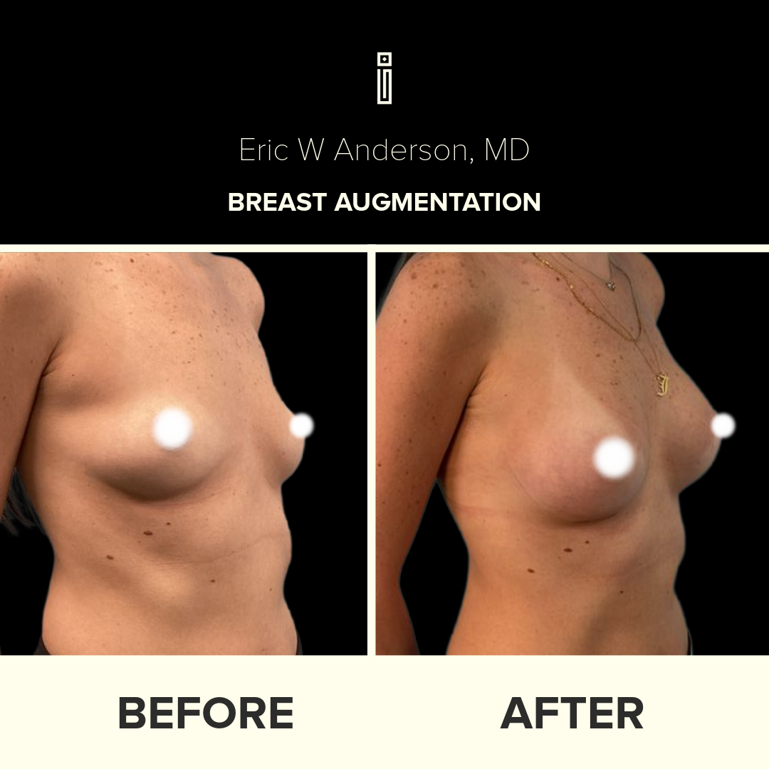 Dr.Anderson_B&A copy-67-Jina Boktor