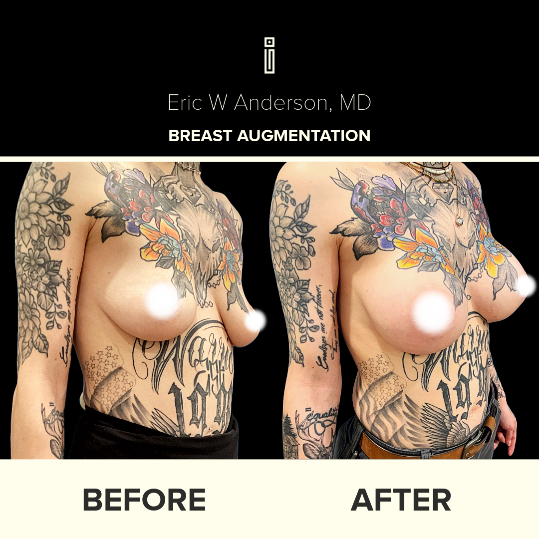 Dr.Anderson_B&A copy-7