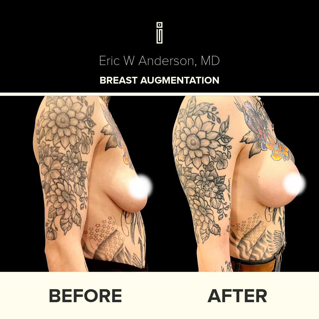 Dr.Anderson_B&A copy-8