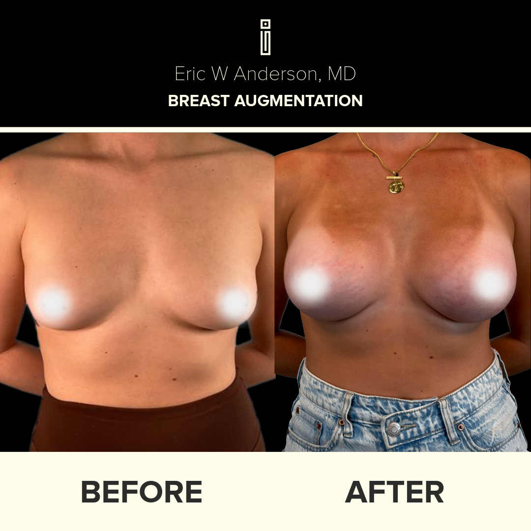 Dr.Anderson_B&A copy-80-olivia. b