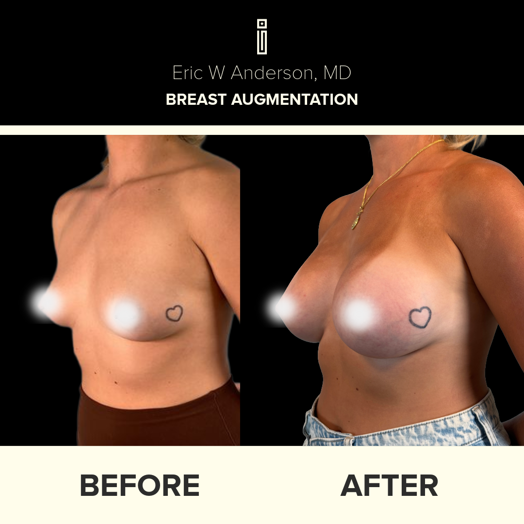 Dr.Anderson_B&A copy-81-olivia. b (1)