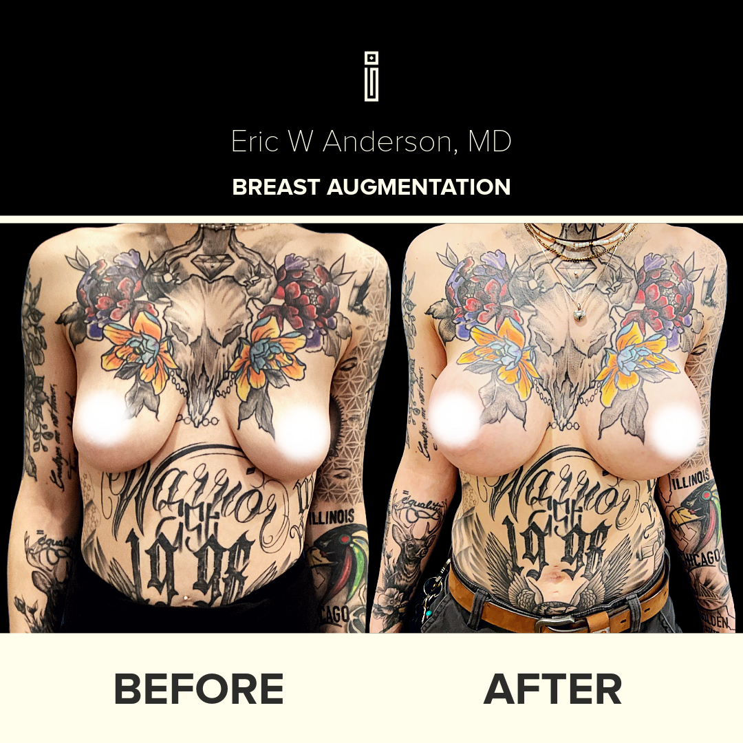 Dr.Anderson_B&A copy-9-1