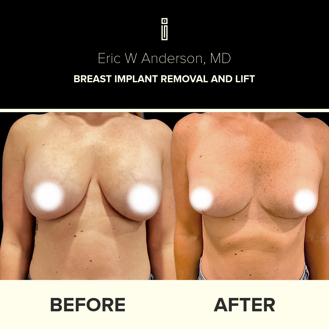 Dr.Anderson_B&A-1 (1)