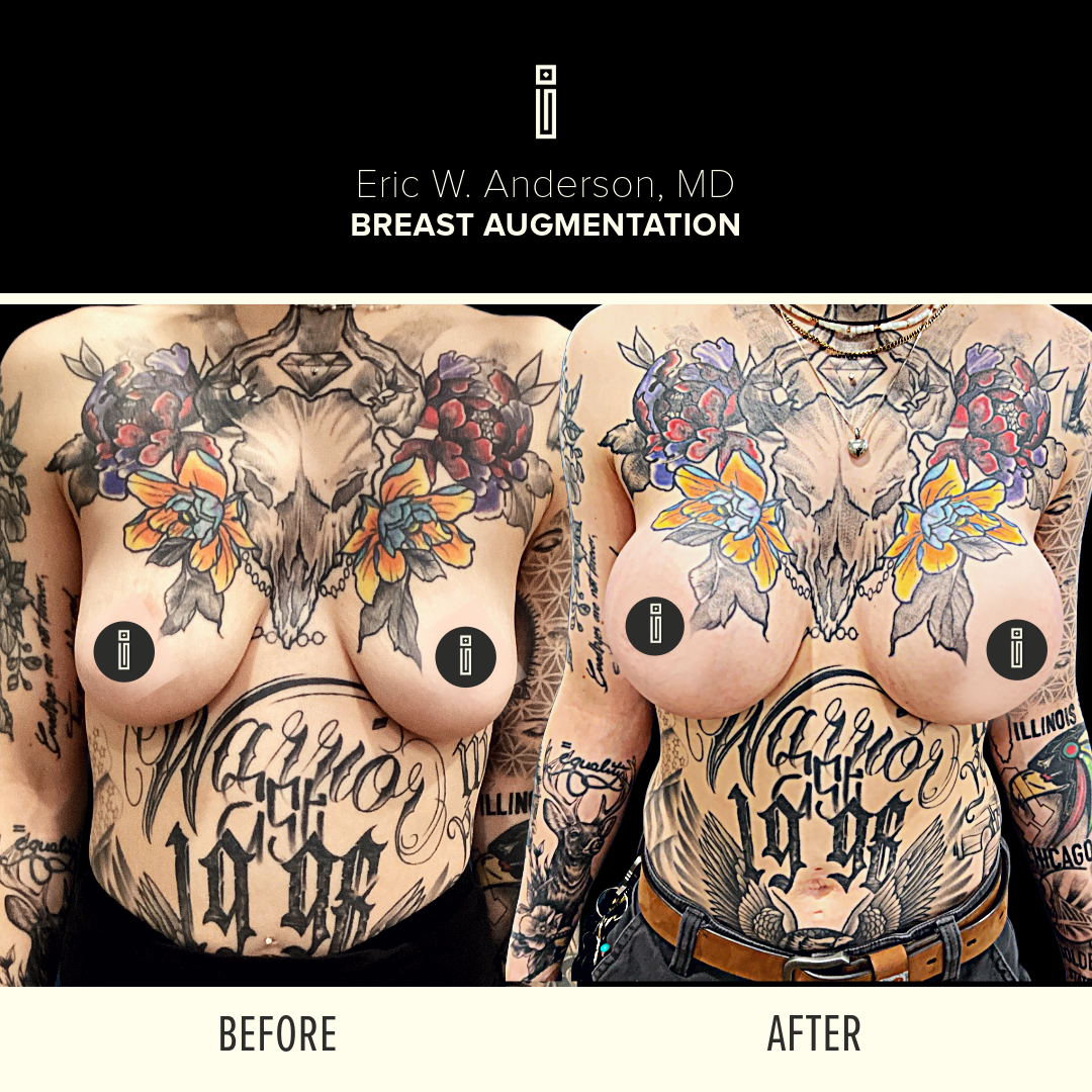 Dr.Anderson_B&A-12
