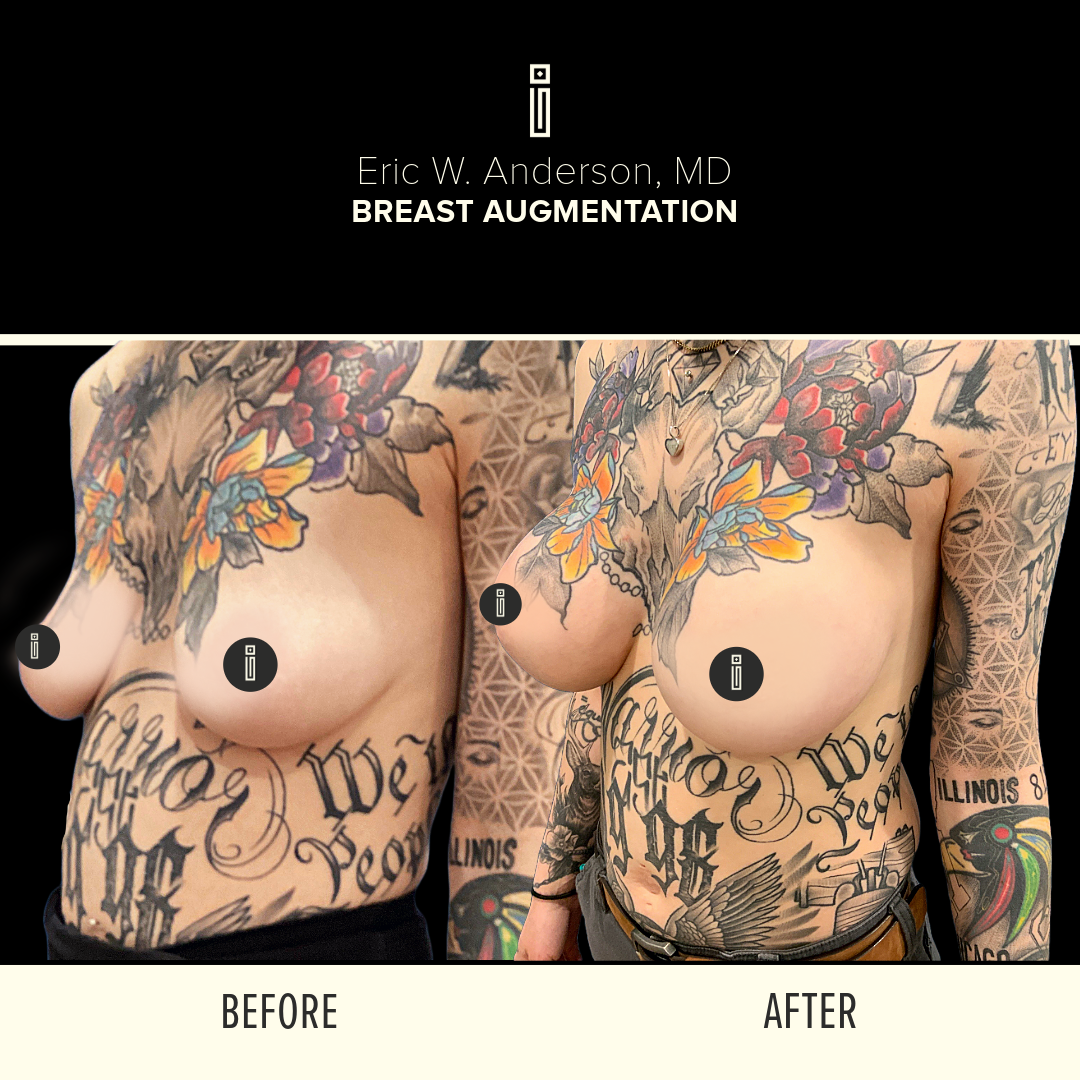 Dr.Anderson_B&A-13