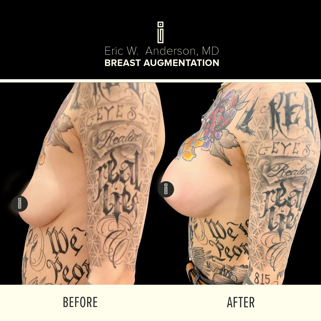 Dr.Anderson_B&A-14-1