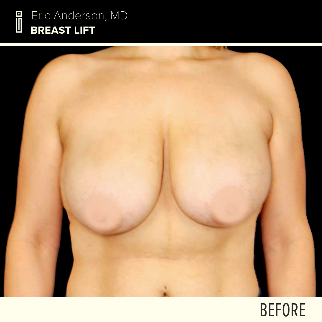 Dr.Anderson_B&A-2-Megan Bilodeau1