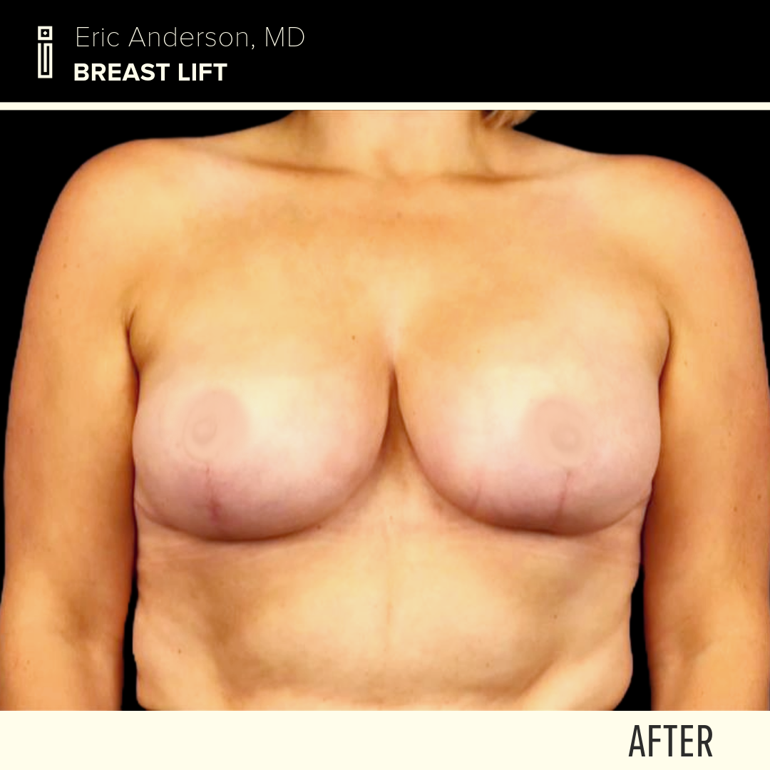 Dr.Anderson_B&A-3-Megan Bilodeau2