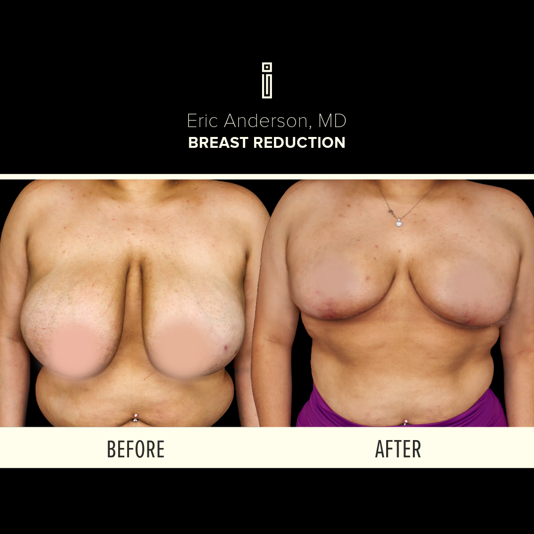 Dr.Anderson_B&A-48