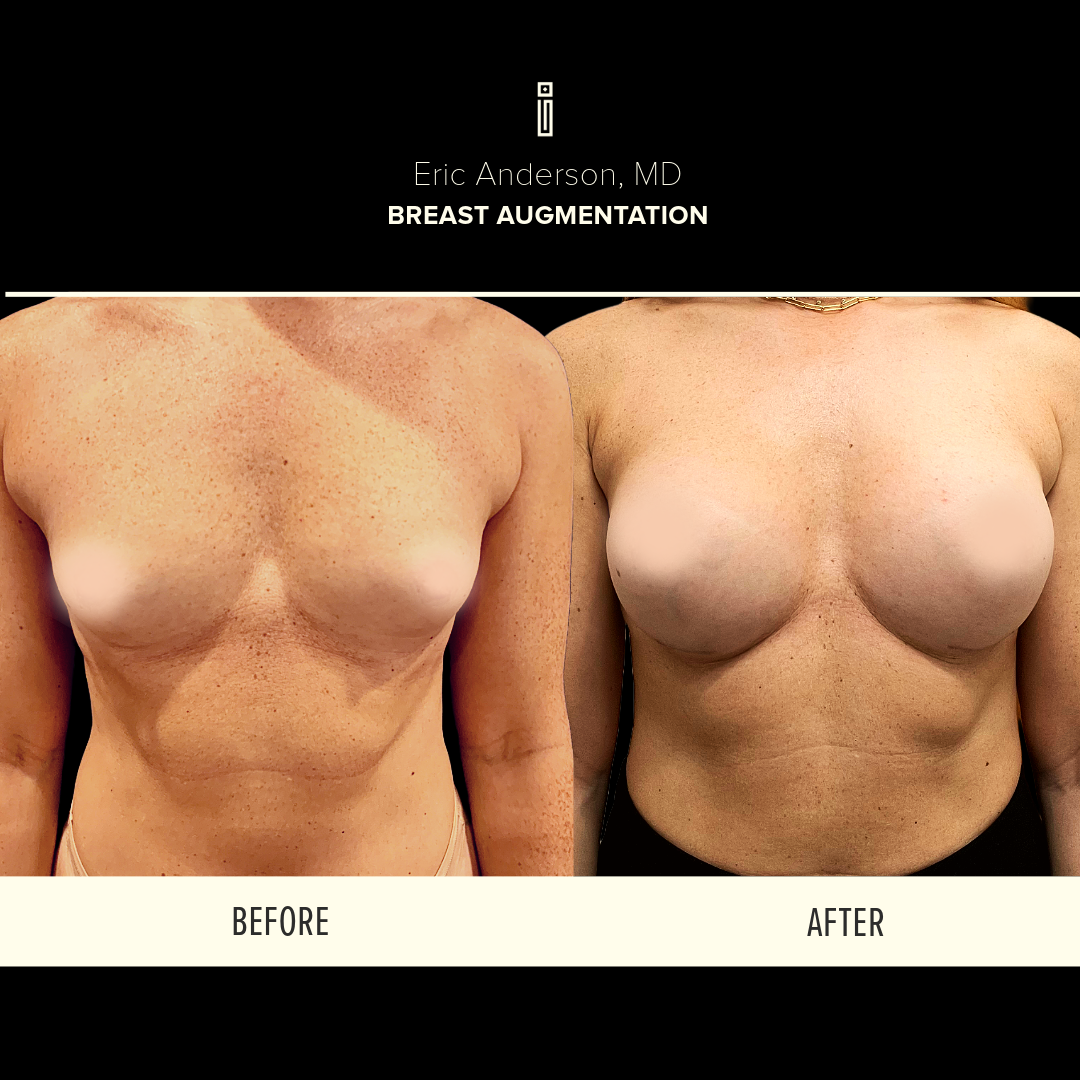 Dr.Anderson_B&A-49