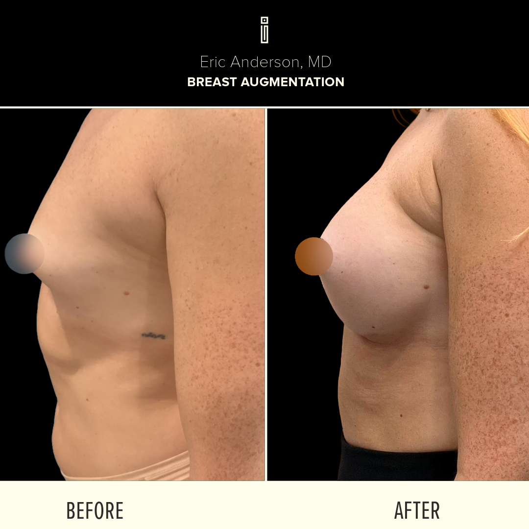 Dr.Anderson_B&A-52