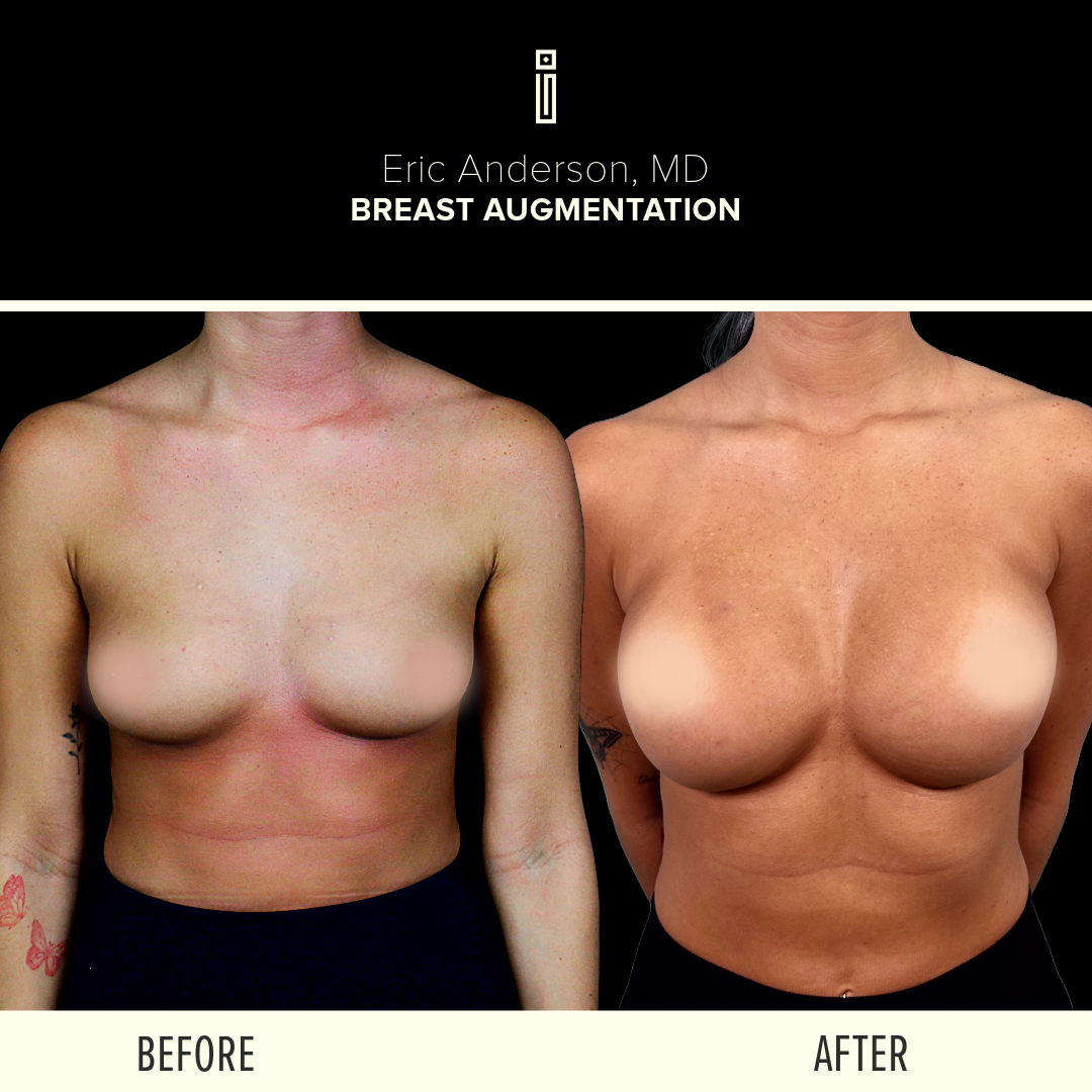 Dr.Anderson_B&A-57 (1)