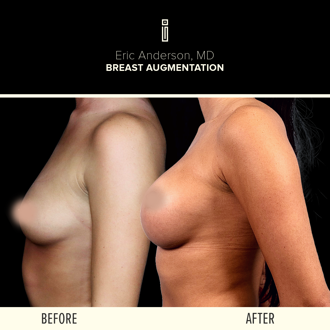 Dr.Anderson_B&A-60 (1)