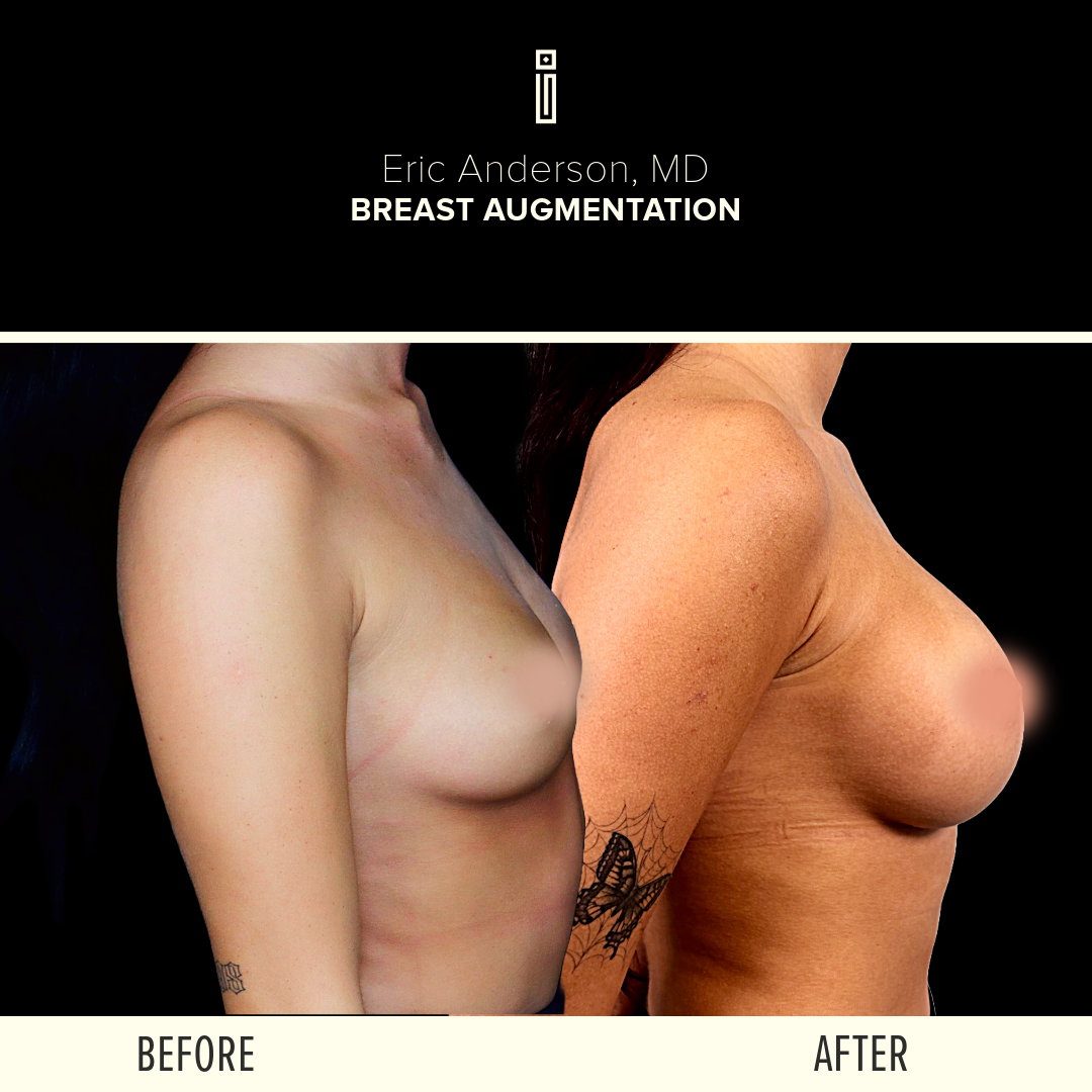 Dr.Anderson_B&A-61 (1)