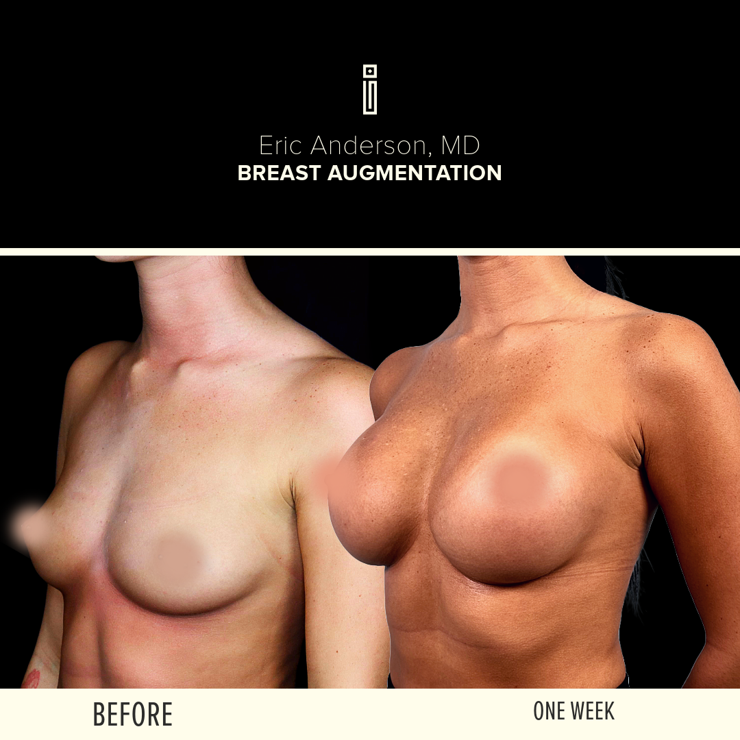 Dr.Anderson_B&A-62 (1)