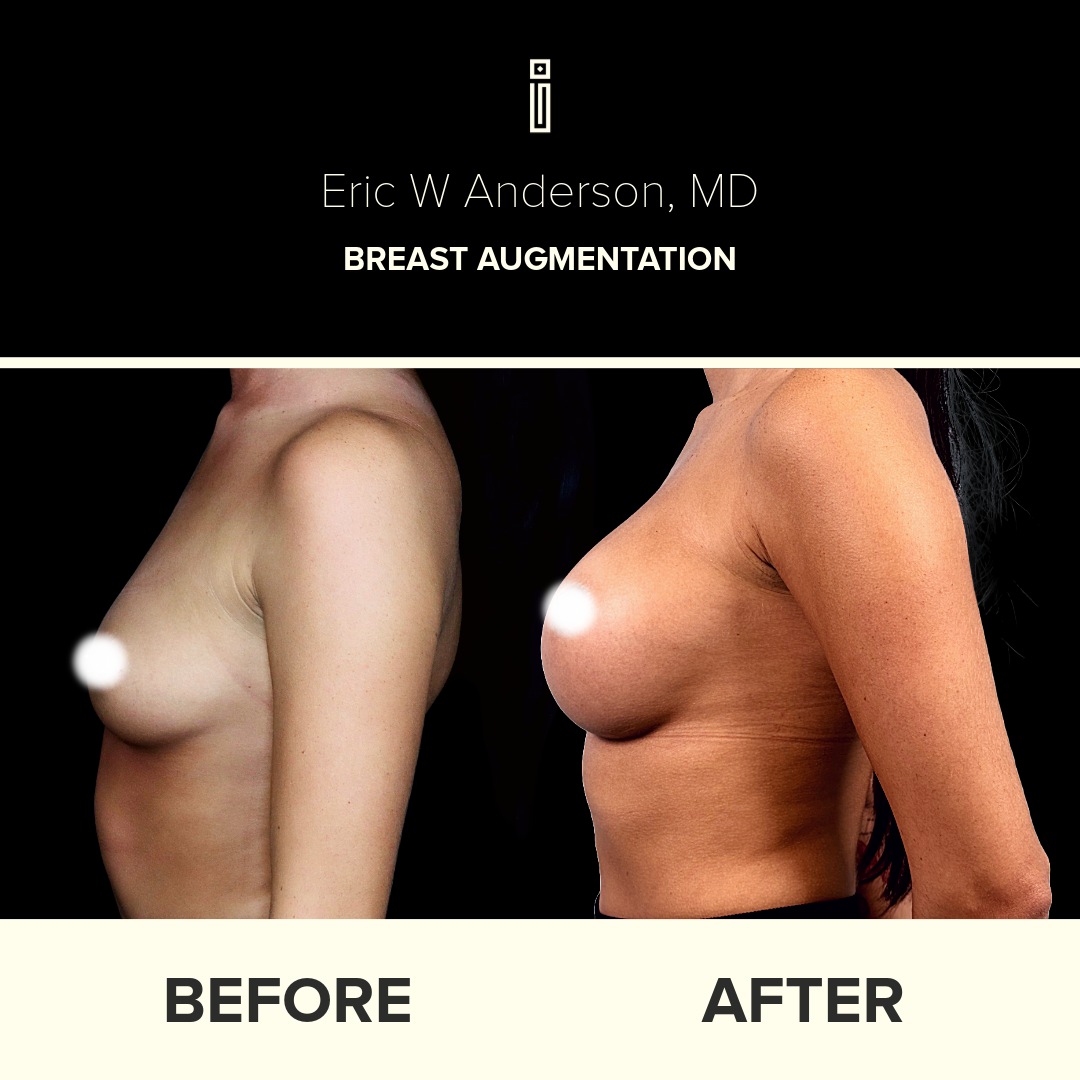 Dr.Anderson_B&A-62-1