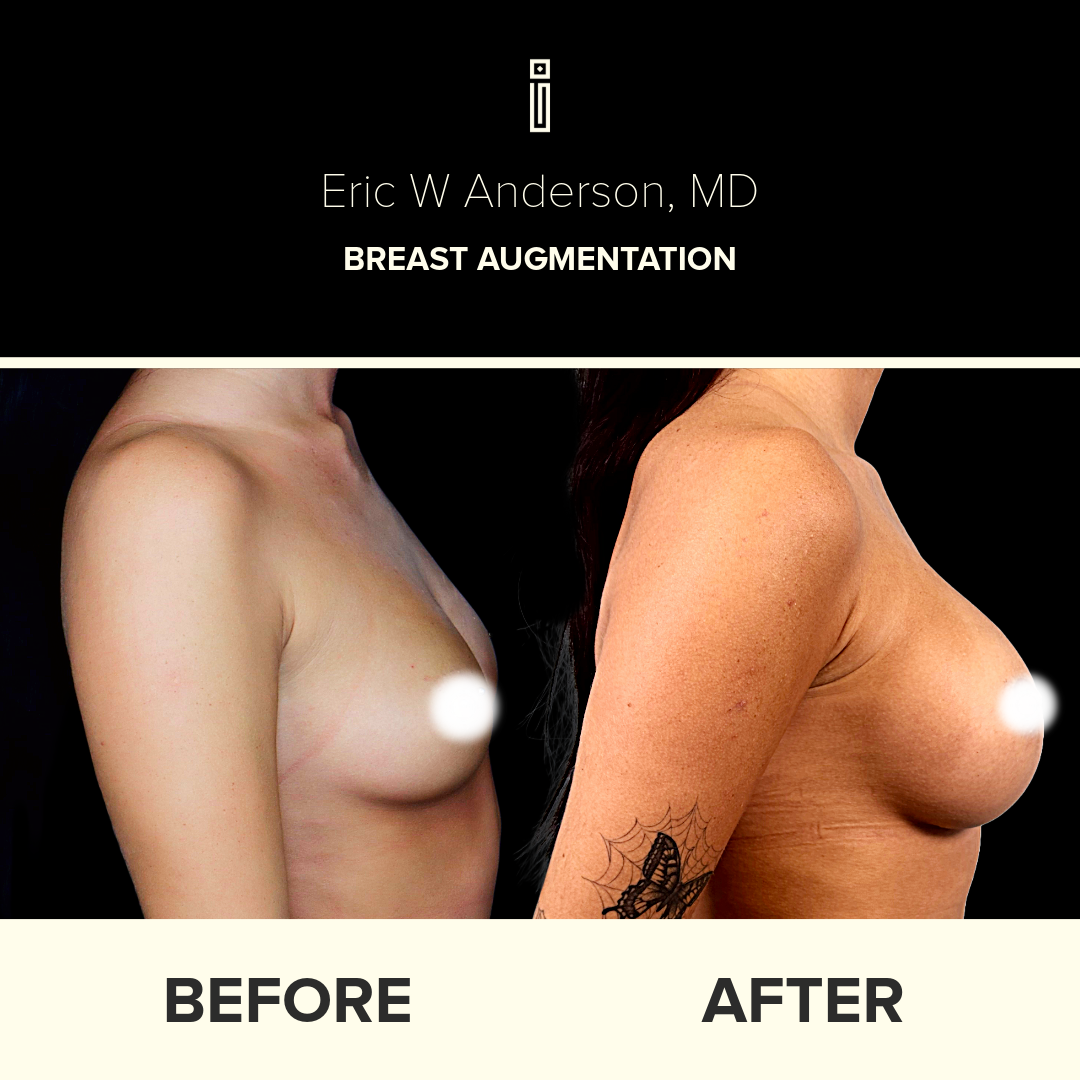 Dr.Anderson_B&A-63-1