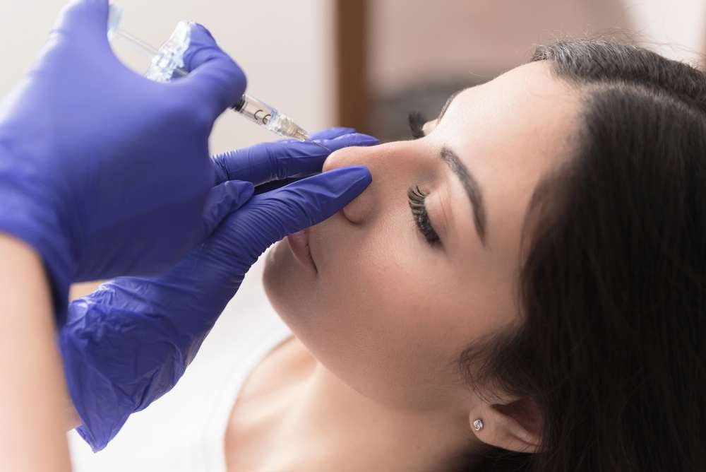 Alternatives to Rhinoplasty
