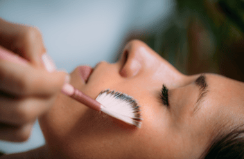 TCA Peel: Preparation, Procedure, and Recovery