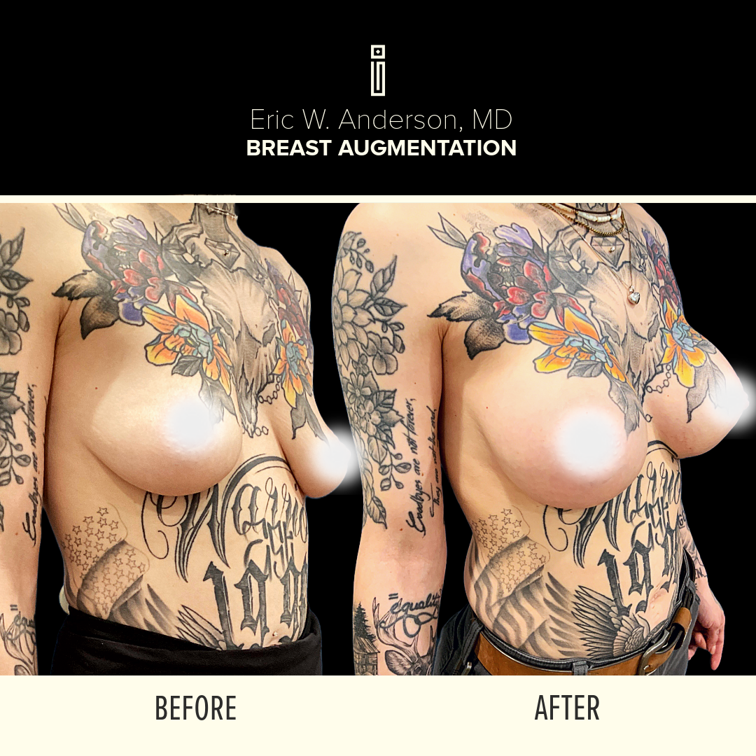 Dr.Anderson_B&A 