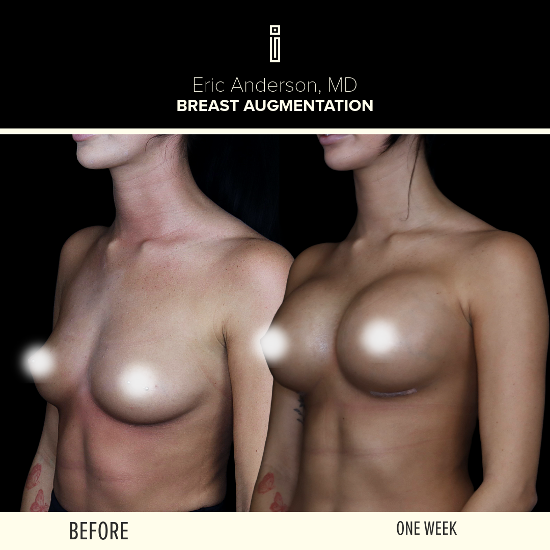 Dr.Anderson_B&A 