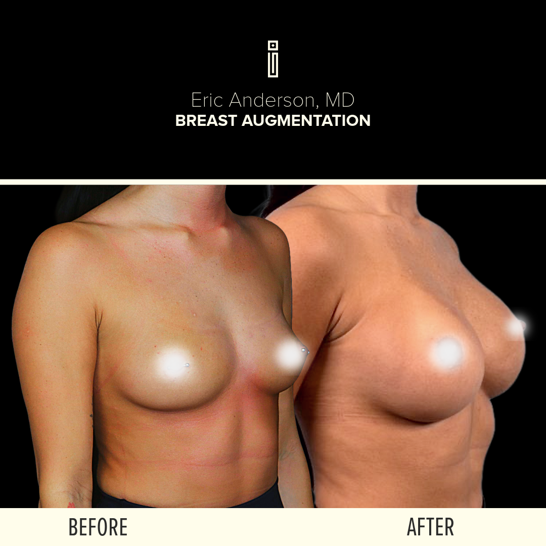 Dr.Anderson_B&A 