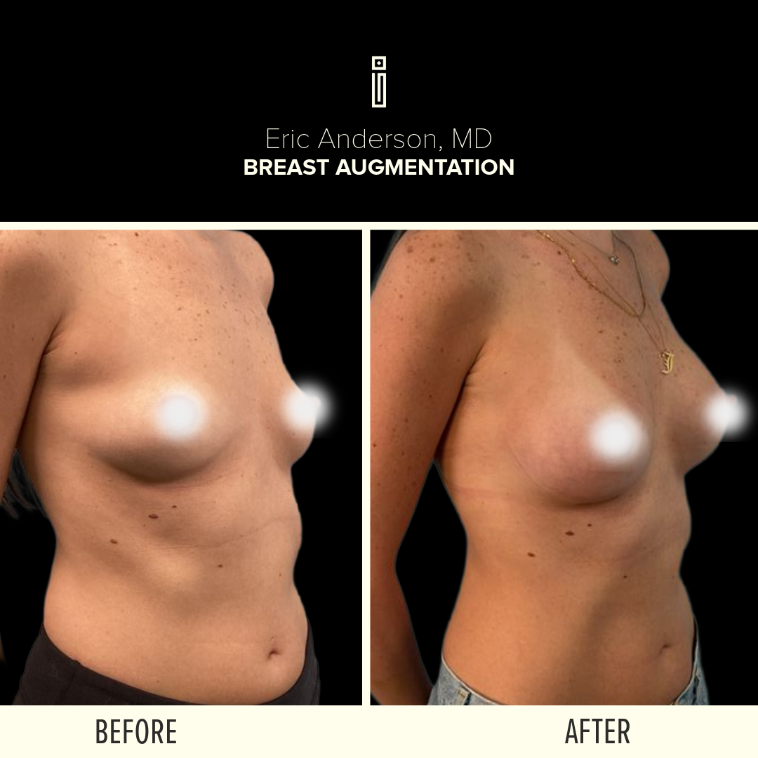 Body Before and After