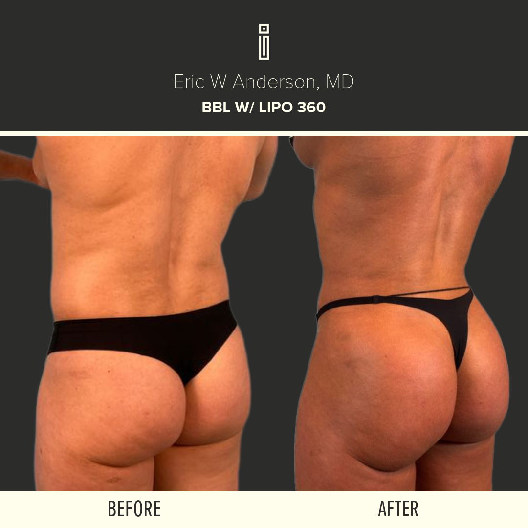 Dr.Anderson_B&A copy-82-MEGAN .O SIDE