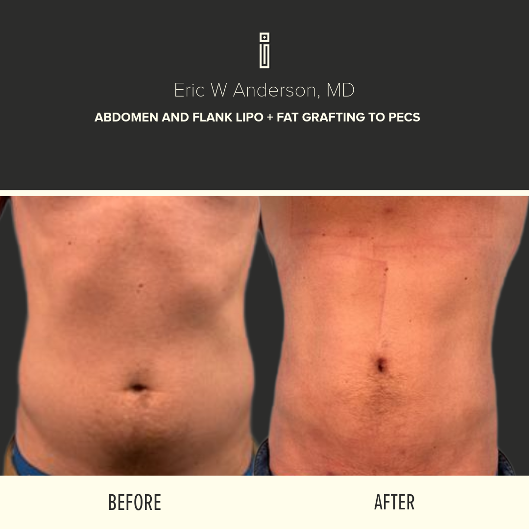 Body Before and After