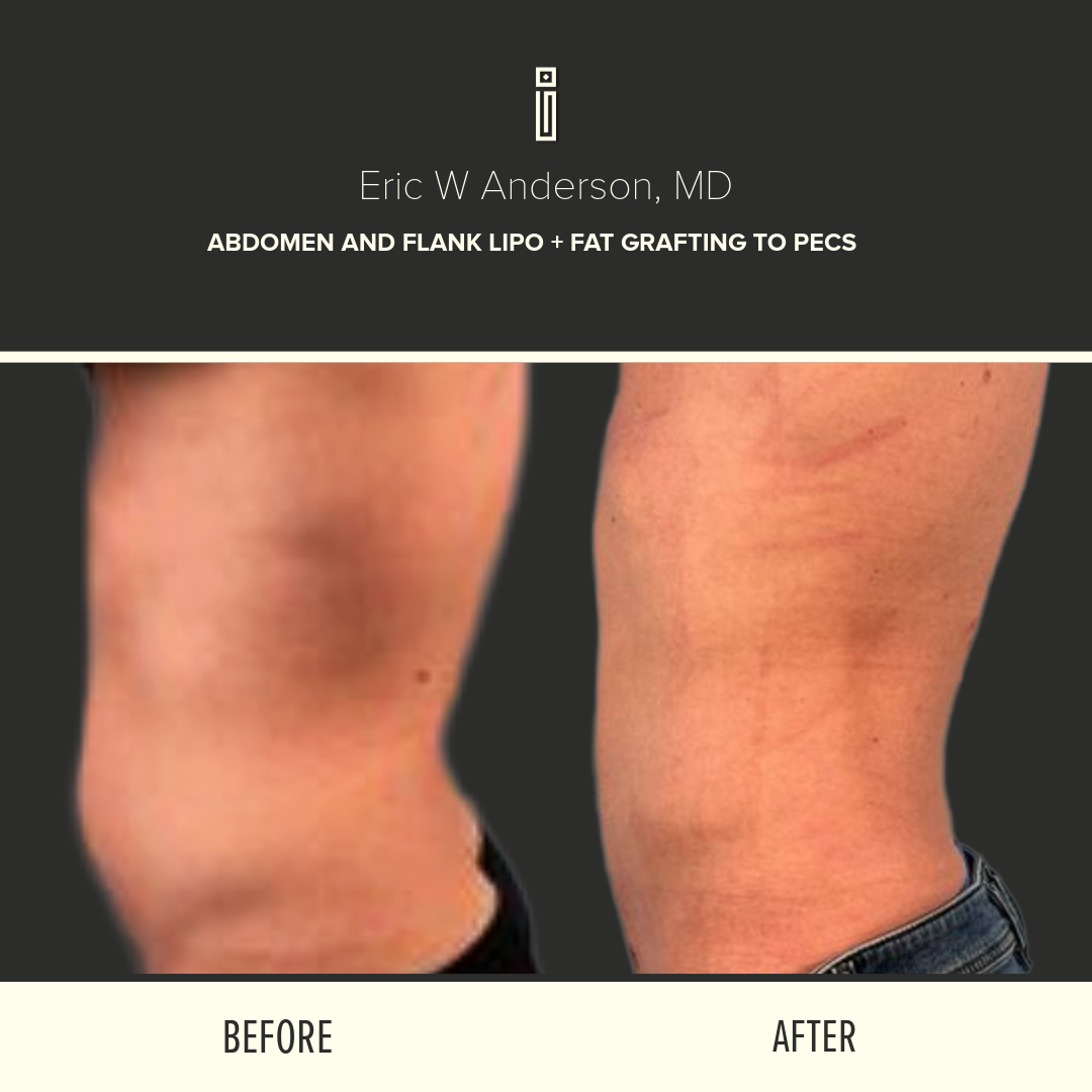 Body Before and After