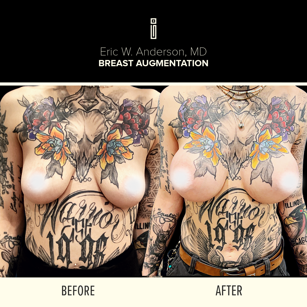 Dr.Anderson_B&A 