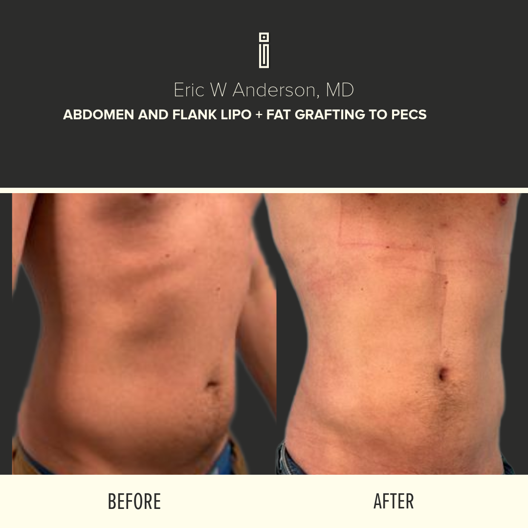 Body Before and After