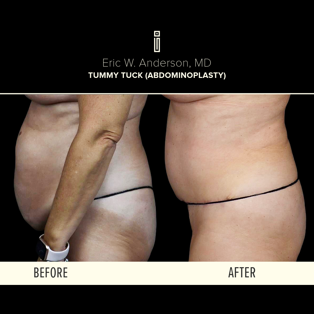 Dr.Anderson_B&A-2-Roche2 (2)