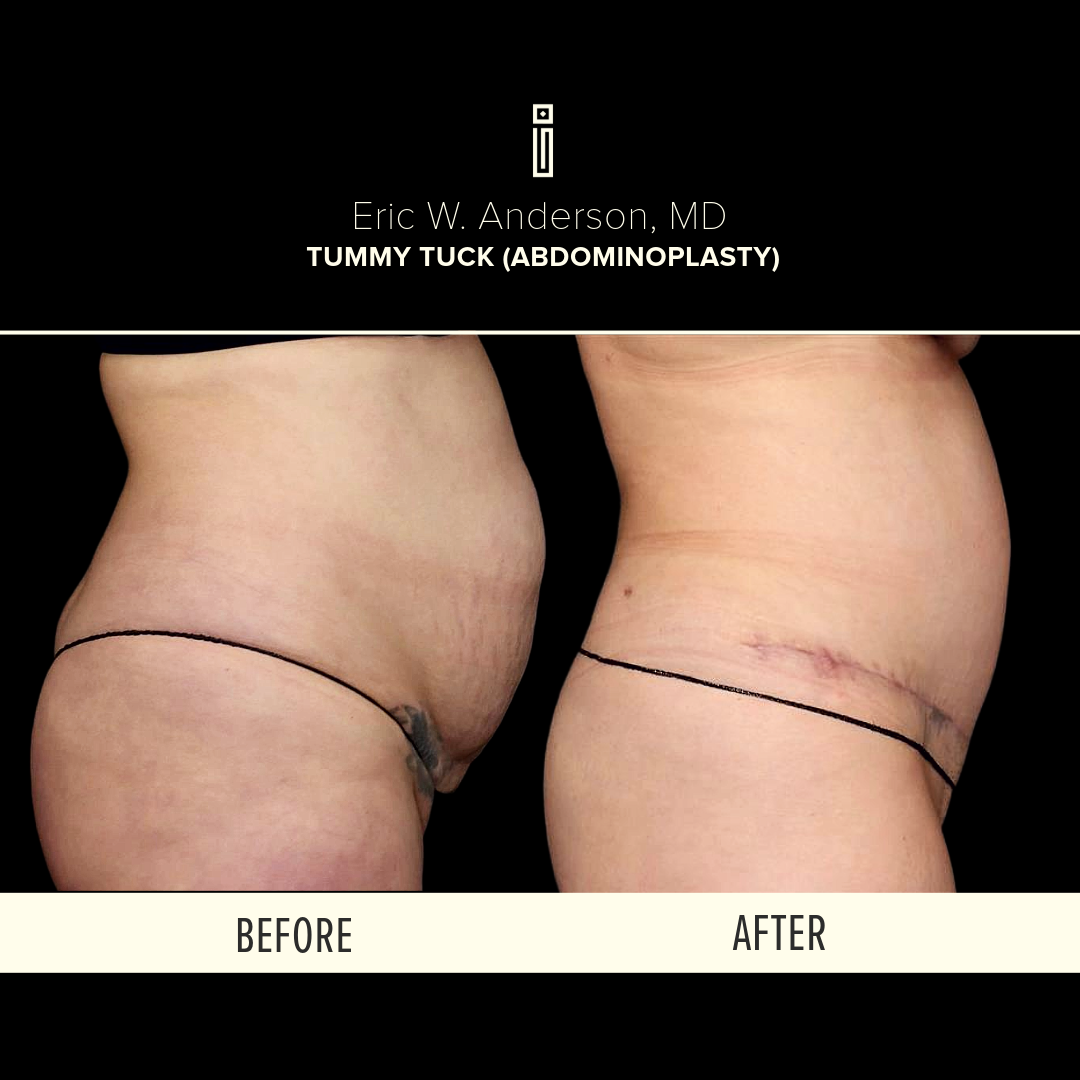 Dr.Anderson_B&A-3-Roche3