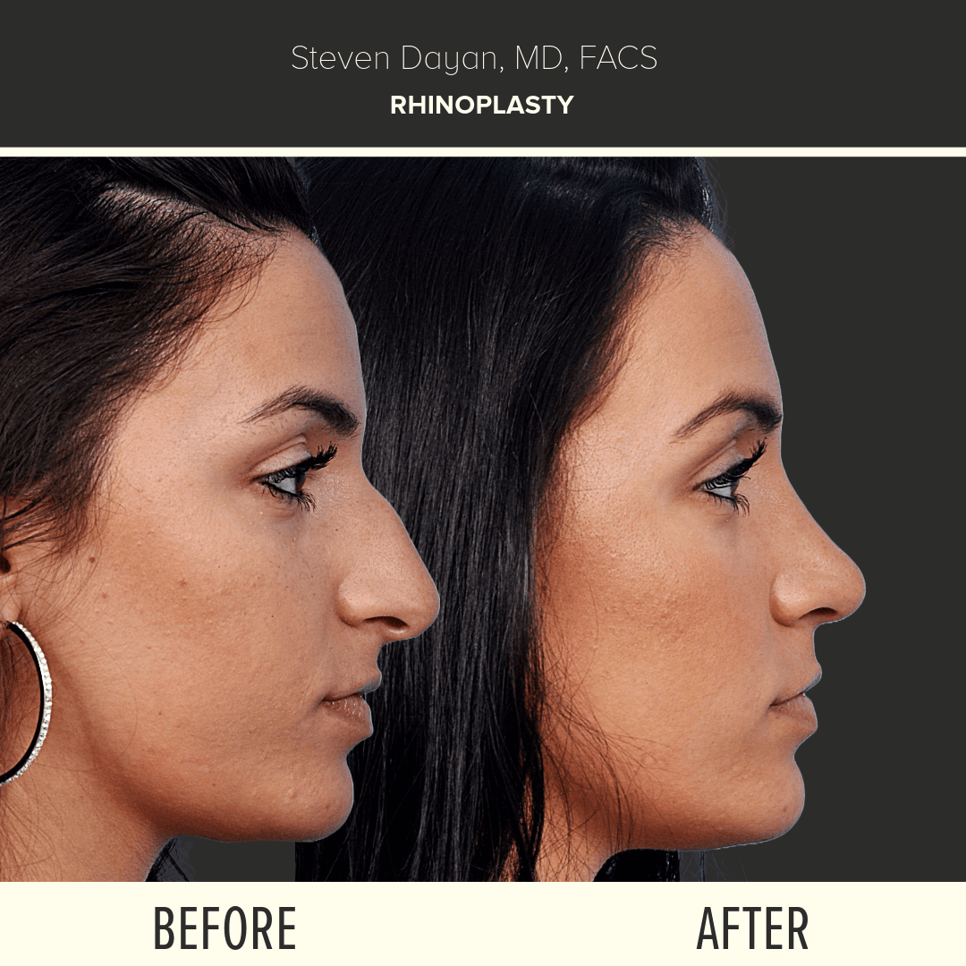 Before After image