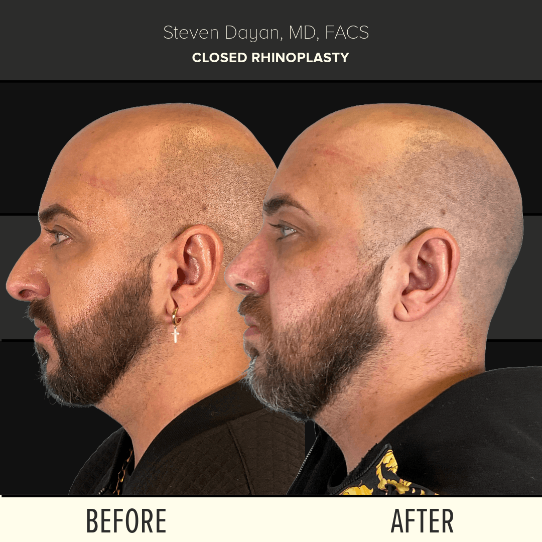 Before After image
