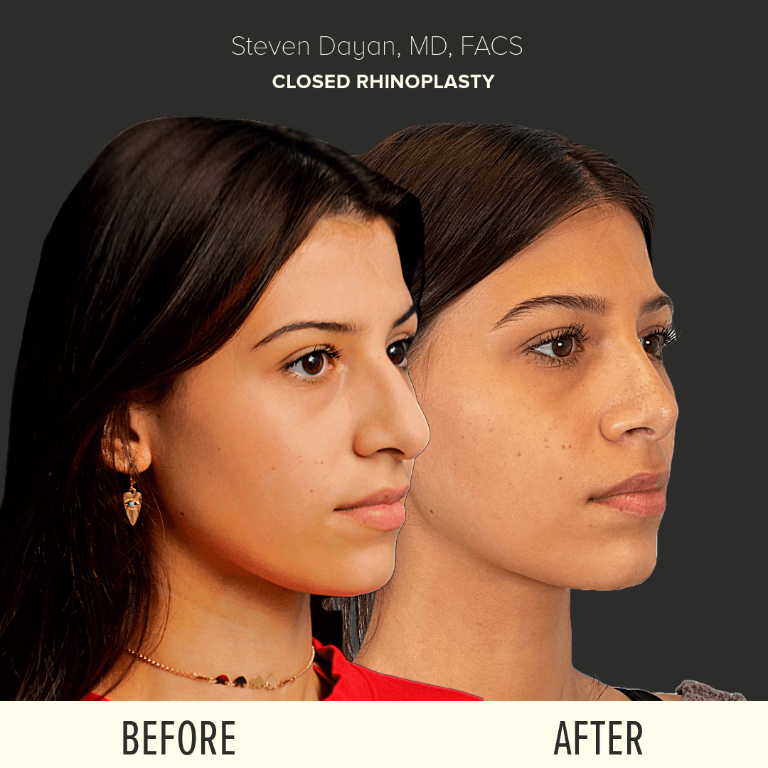 Before After image