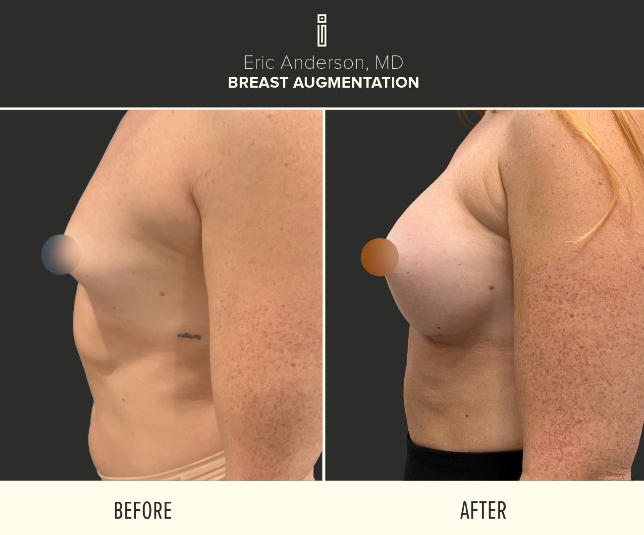 Dr.Anderson_B&A-22