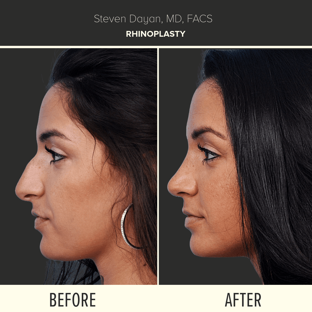 Before After image