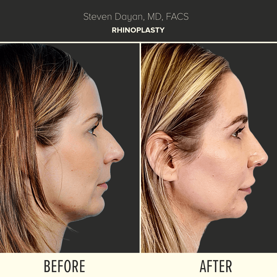 Before After image