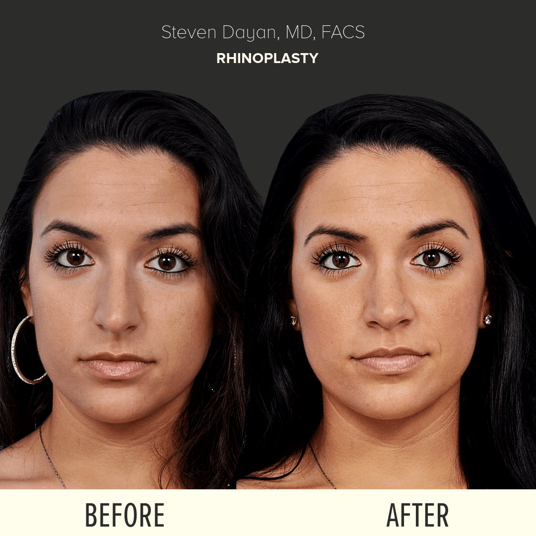 Before After image